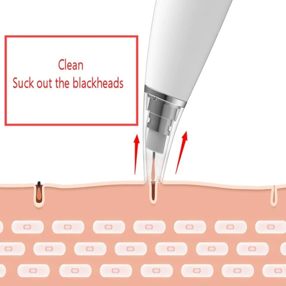 Original Xiaomi inFace MS7000 electric blackhead remover at Holooz